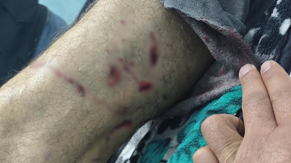 Diyarbakır’da yaşlı adama sokak köpekleri saldırdı